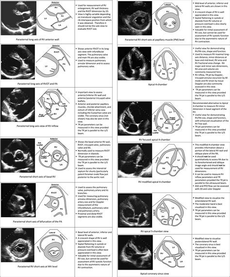 lv motion|THE AMERICAN SOCIETY OF ECHOCARDIOGRAPHY RECOMMENDATIONS FOR CARDIAC .